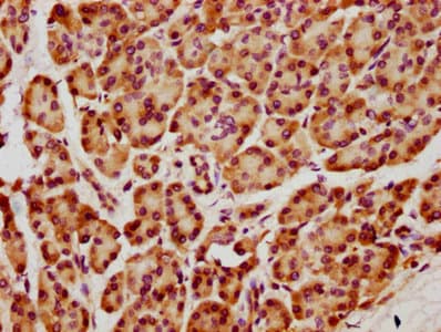 Polyclonal Rabbit anti-Human HIST1H2AB Antibody (IHC)