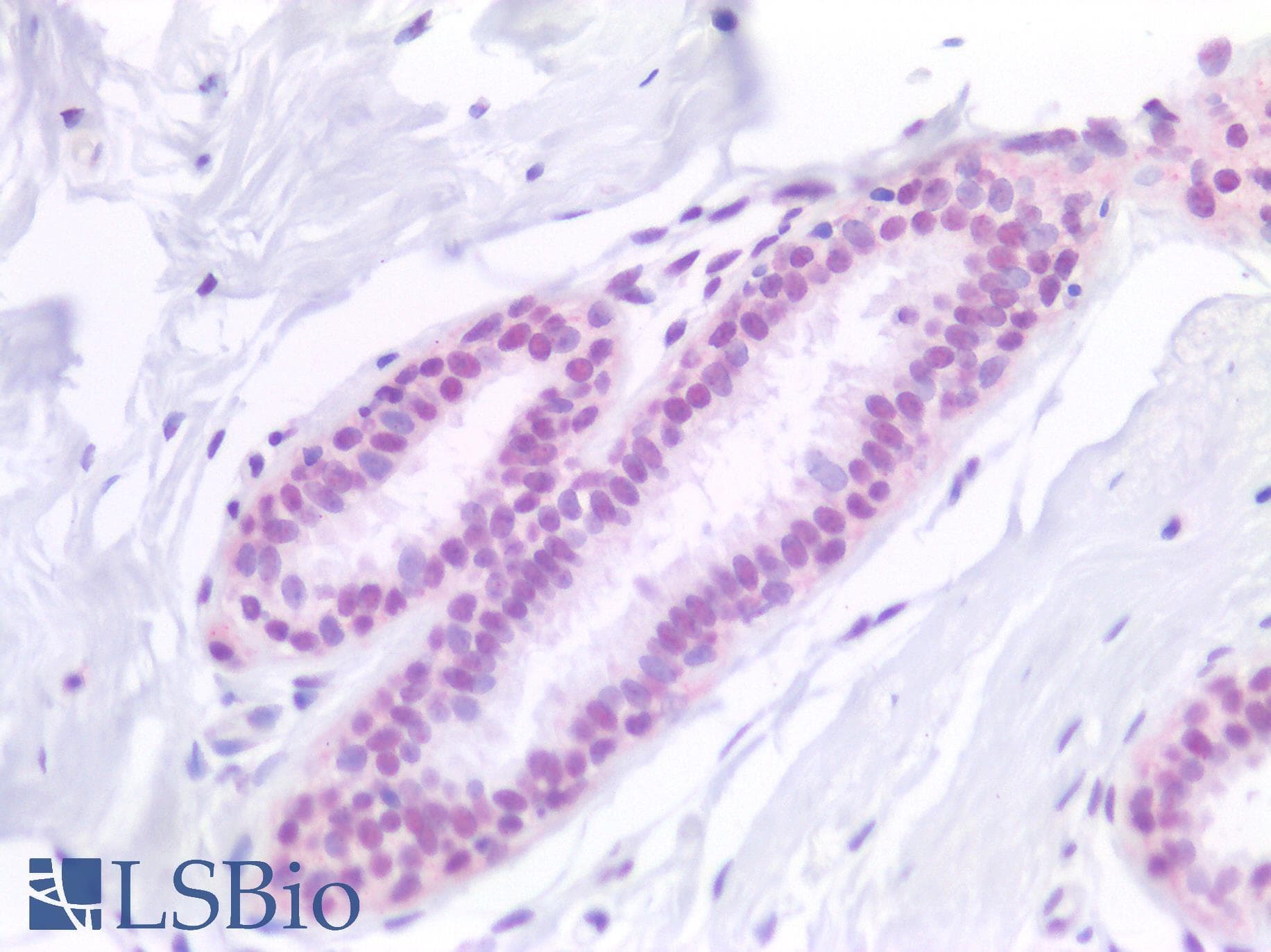 IHC-plus™ SF1 Antibody
