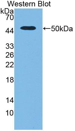 PLAU / Urokinase / uPA Antibody (aa17-432)