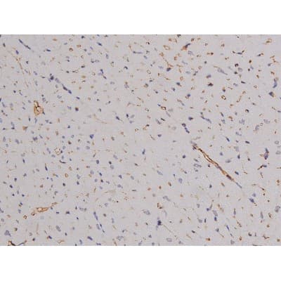 Polyclonal Rabbit anti-Human BCL2L1 / BCL-XL Antibody (phospho-Thr47, IHC, IF, WB)