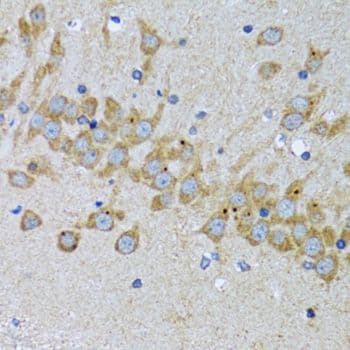 Polyclonal Rabbit anti-Human GCN2 Antibody (IHC, IF, WB)
