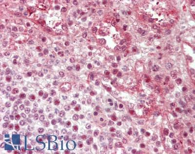 IHC-plus™ SRRT / ARS2 Antibody (aa627-876)