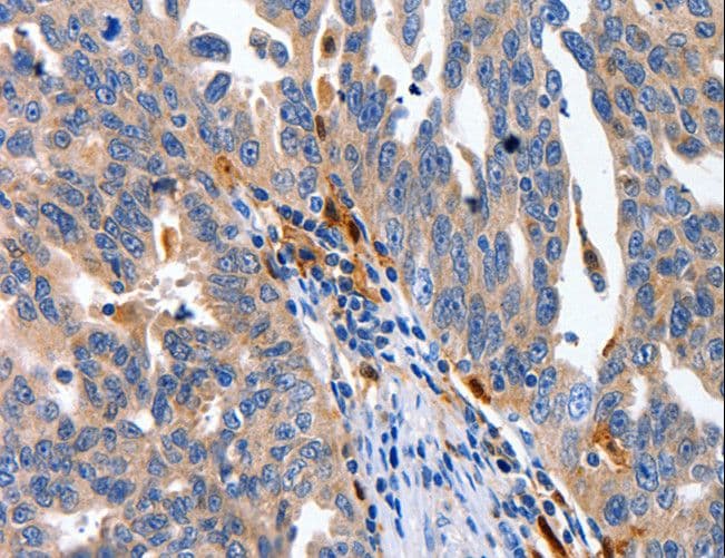 IL18 Antibody