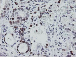 Monoclonal Mouse anti-Human EGR2 Antibody (clone OTI1B12, IHC, IF, WB)