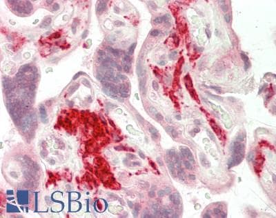IHC-plus™ CD163 Antibody (clone 3D4)