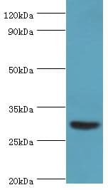 BAFF / TNFSF13B Antibody (aa76-285)