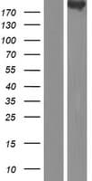 CDC42BPB / MRCKB Protein (Over-Expression Lysate Myc-DDK (Flag))