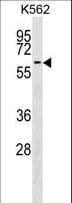 Polyclonal Rabbit anti-Human F9 / Factor IX Antibody (aa266-295, WB)