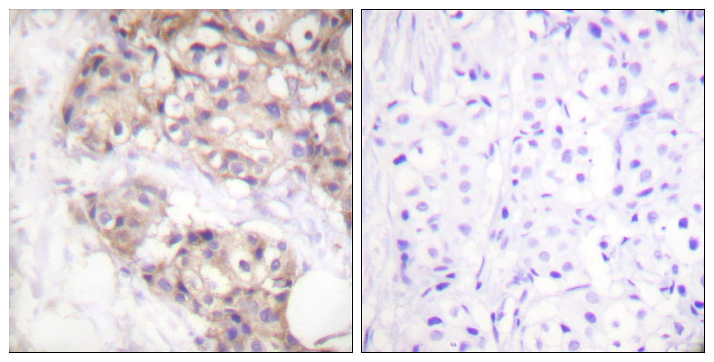 PAK2 Antibody (aa5-54)