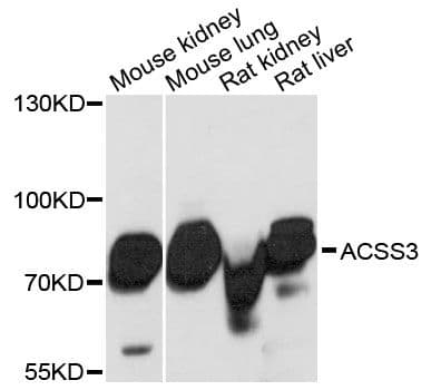ACSS3 Antibody