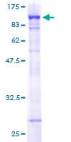 Human PARN Protein (Recombinant GST)