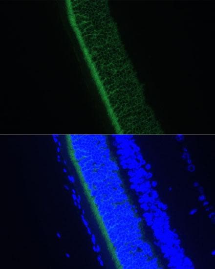 GNGT1 Antibody