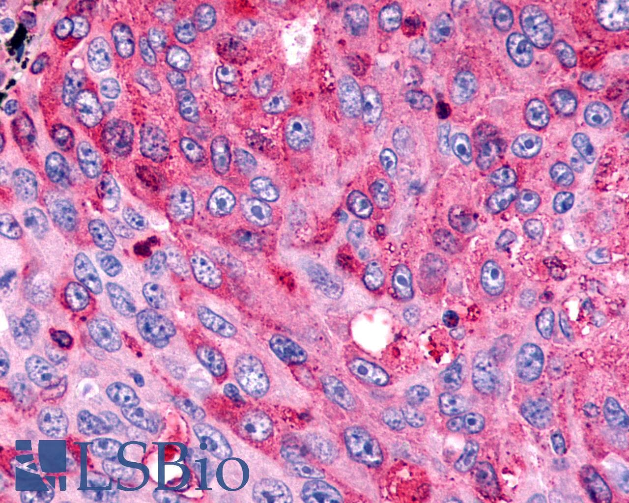 IHC-plus™ FZD7 / Frizzled 7 Antibody (N-Terminus)