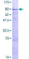 Human ENTPD4 / LALP70 Protein (Recombinant GST)