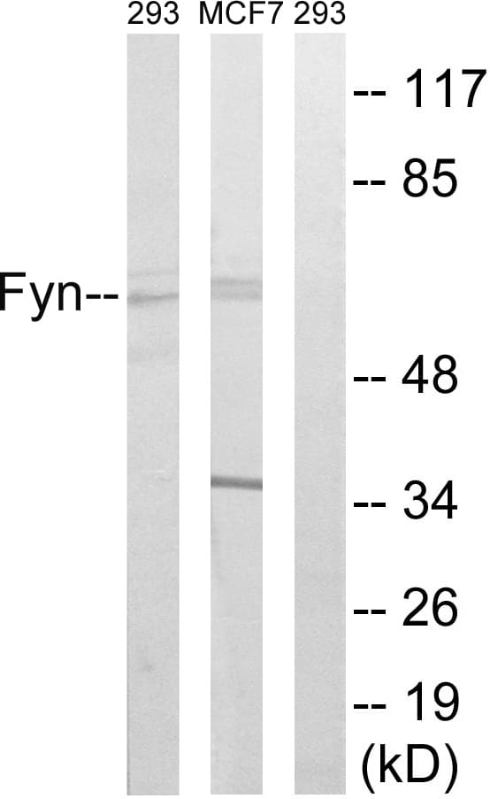 Polyclonal Rabbit anti-Human SYN / FYN Antibody (aa488-537, WB)