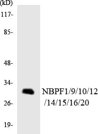 NBPF1+9+10+12+14+15+16+20 Antibody (aa115-164)