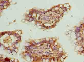 ZNF281 / Zfp281 Antibody