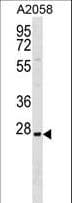 TRIM74 Antibody (aa166-192)