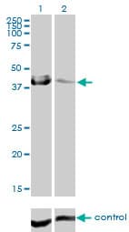 CA12 / Carbonic Anhydrase XII Antibody (clone 1D4)