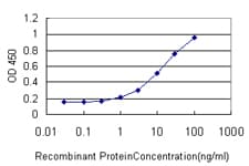 IHC-plus™ HDAC1 Antibody (clone 5A11)
