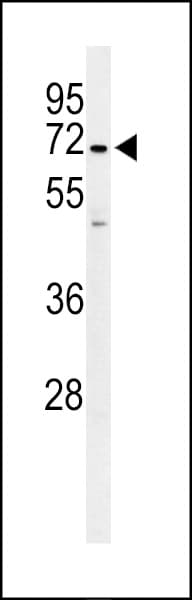 PPP1R18 Antibody (aa192-220)