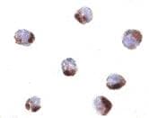 IHC-plus™ PHAP1 / ANP32A Antibody