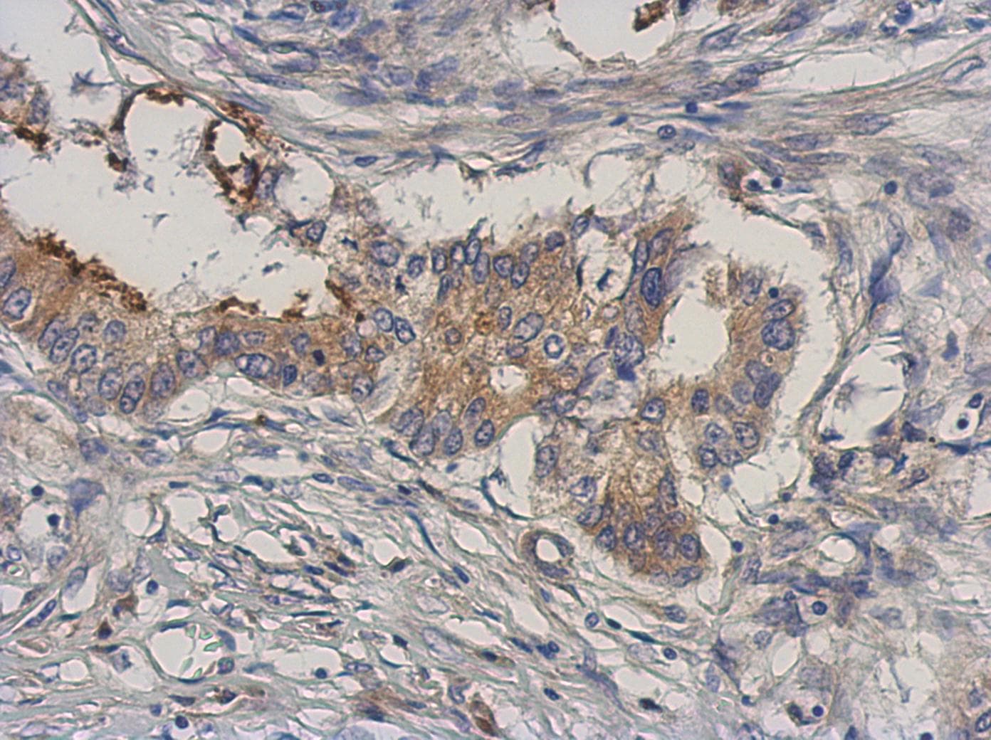 Polyclonal Rabbit anti-Human MAP3K3 / MEKK3 Antibody (Internal, IHC, WB)