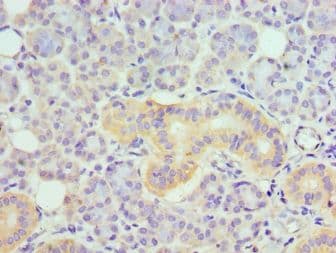 TNFRSF21 / DR6 Antibody (aa371-655)