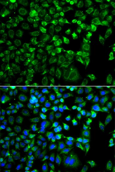 ZAK / MLTK Antibody