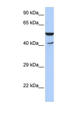 Polyclonal Rabbit anti-Human HSPBAP1 Antibody (N-Terminus, WB)
