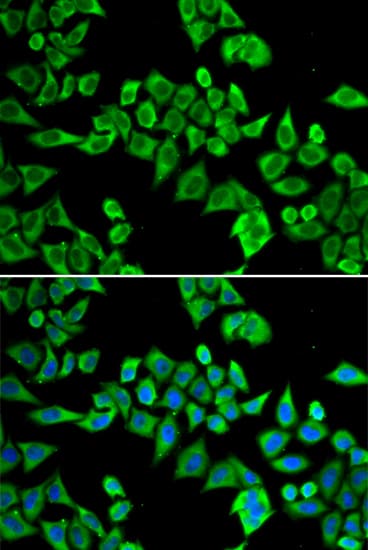 DDX20 / GEMIN3 Antibody