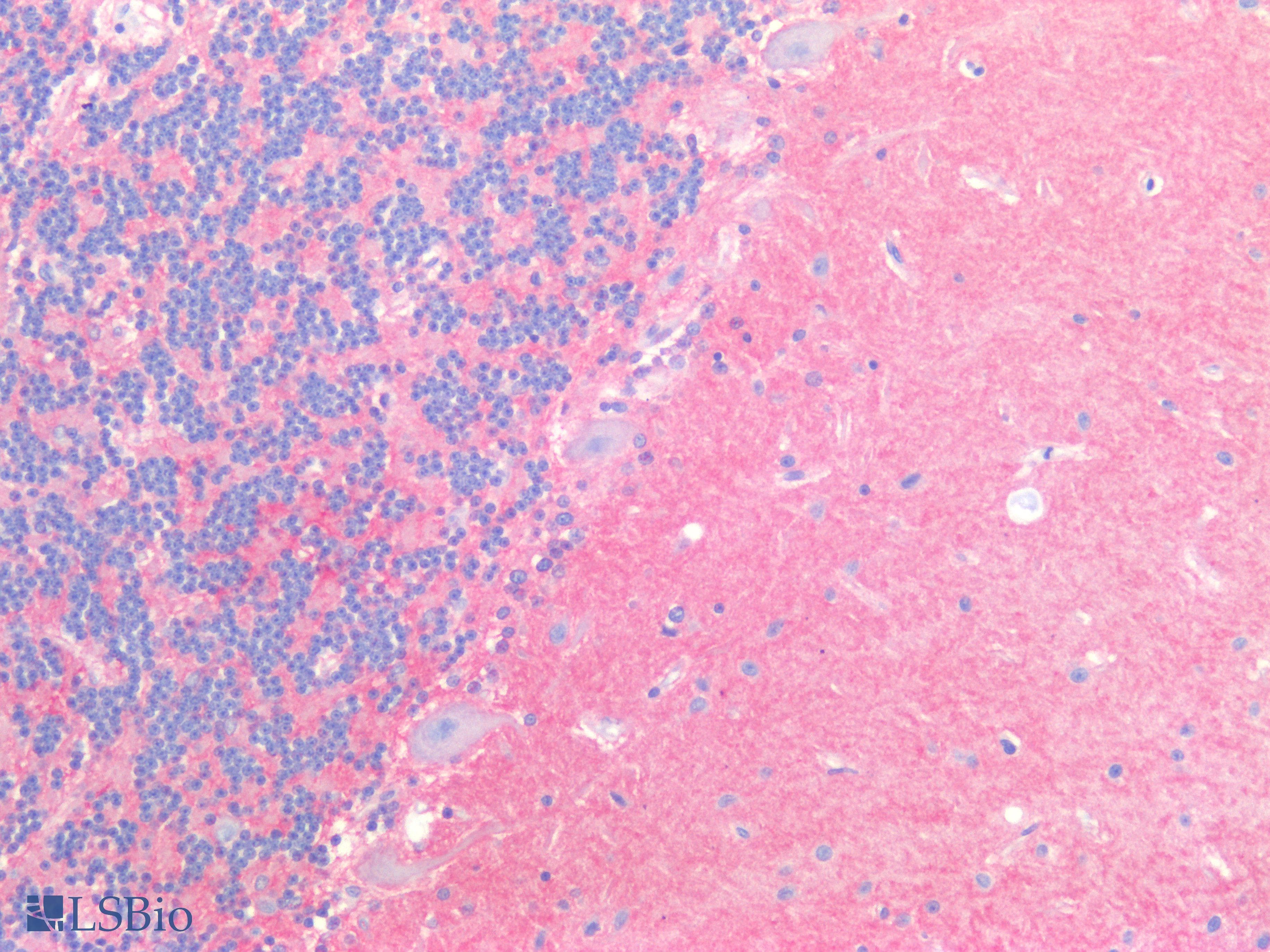 PathPlus™ Polyclonal Rabbit anti-Human SLC1A2 / EAAT2 / GLT-1 Antibody (Cytoplasmic Domain, IHC, WB)