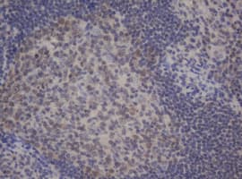 BCL10 / BCL-10 Antibody (clone OTI4H9)
