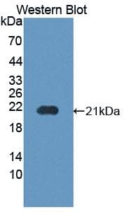 PPIB / Cyclophilin B Antibody (aa34-216)