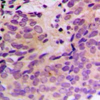 CERKL Antibody (Internal)