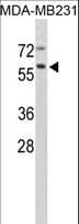 Polyclonal Rabbit anti-Human CTSF / Cathepsin F Antibody (aa261-290, IHC, WB)