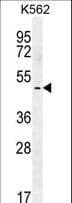 Polyclonal Rabbit anti-Human TBX6 Antibody (aa143-172, WB)