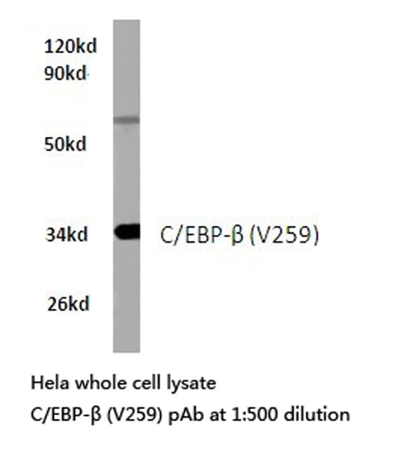 Polyclonal Rabbit anti-Human C/EBP Beta / CEBPB Antibody (Val259, IHC, WB)