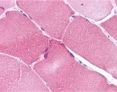 Polyclonal Rabbit anti-Human NOL3 / ARC Antibody (IHC, WB)