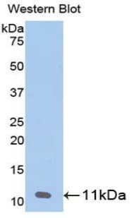 CXCL7 / PPBP Antibody (aa59-128)
