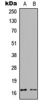 CALM1 / Calmodulin Antibody (phospho-Thr80/Ser82)