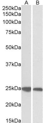 IHC-plus™ GRB2 Antibody (aa206-217)