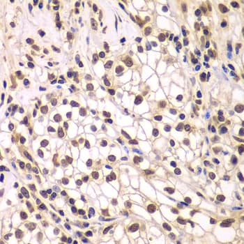 SMARCC1 / SWI3 Antibody