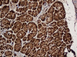 PAI-RBP1 / SERBP1 Antibody (clone OTI5G2)