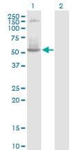 DNTT / TdT Antibody (clone 4H5)