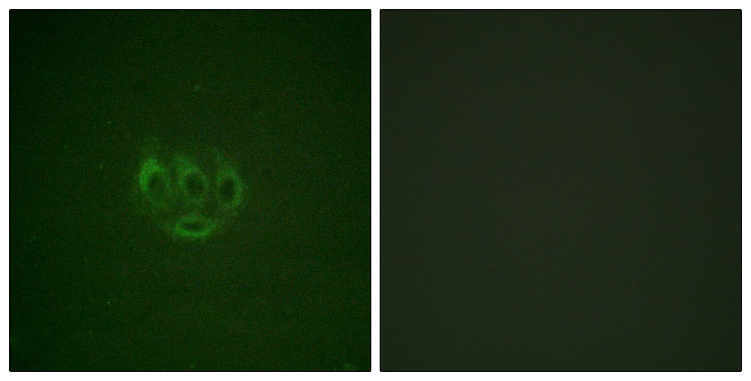 TNK2 / ACK1 Antibody (phospho-Tyr284)
