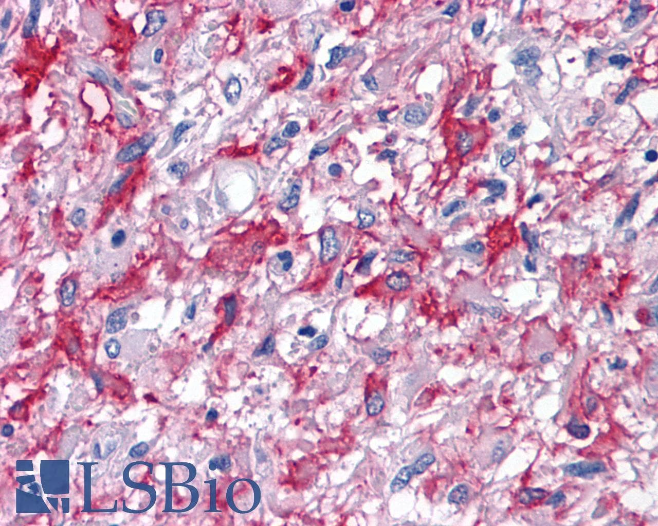 IHC-plus™ Polyclonal Rabbit anti-Human CNR2 / CB2 Antibody (Internal, IHC)