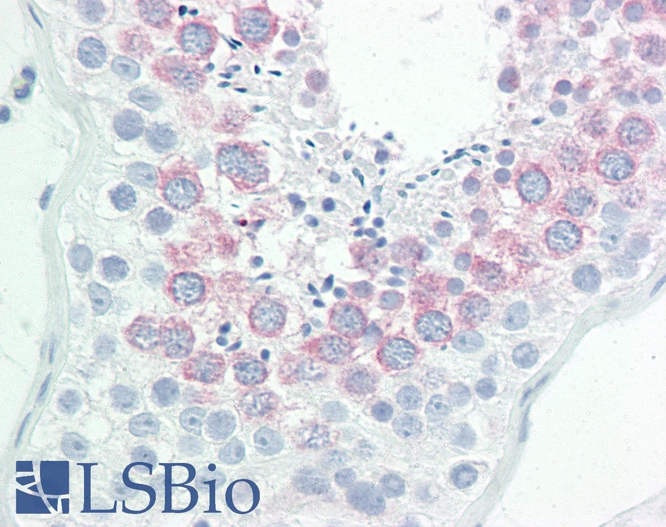 IHC-plus™ TG737 / IFT88 Antibody (aa791-820)