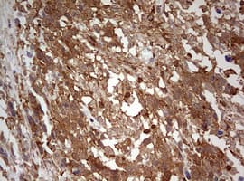 Monoclonal Mouse anti-Human ARFL3 / ARL3 Antibody (clone OTI1C6, aa2-182, IHC, WB)