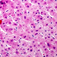 Complement C9 Antibody (Internal)